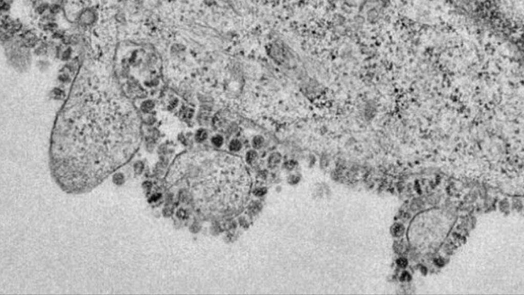 Pesquisa brasileira identifica remédio que pode frear replicação do novo vírus