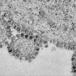 Pesquisa brasileira identifica remédio que pode frear replicação do novo vírus