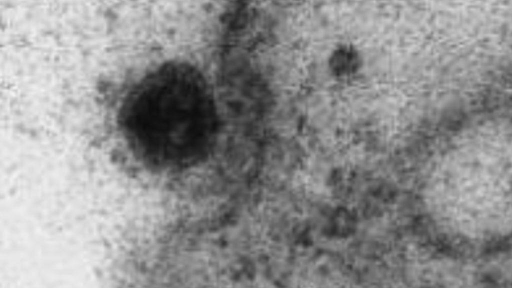 Cientistas brasileiros registram o momento em que o vírus infecta as células