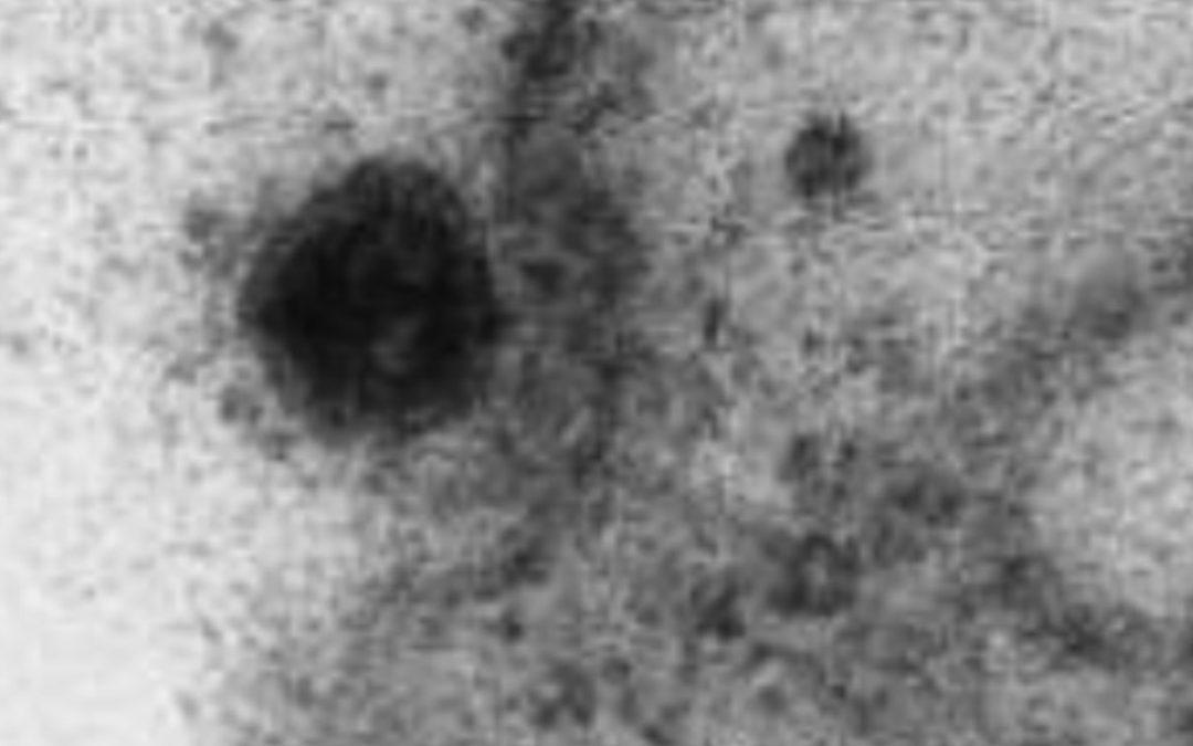 Cientistas brasileiros registram o momento em que o vírus infecta as células