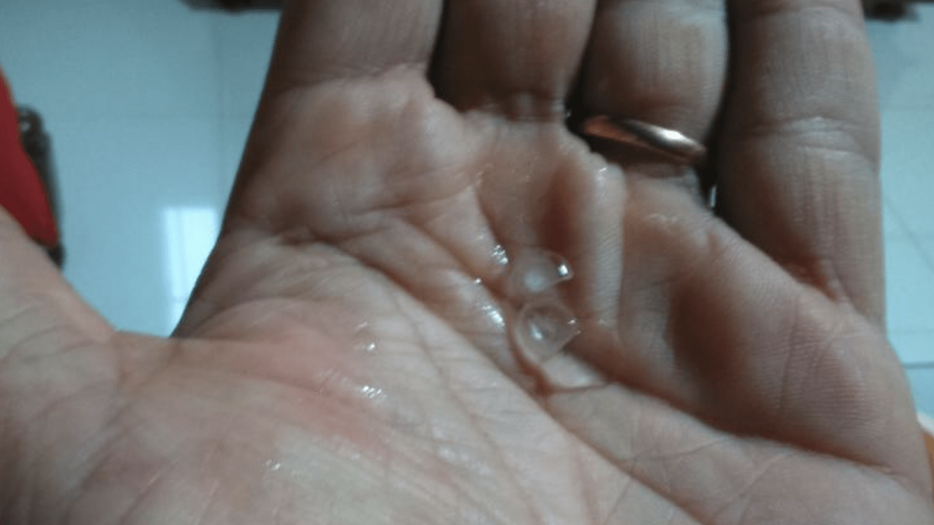 Previsão do Tempo – Semana começa com granizo